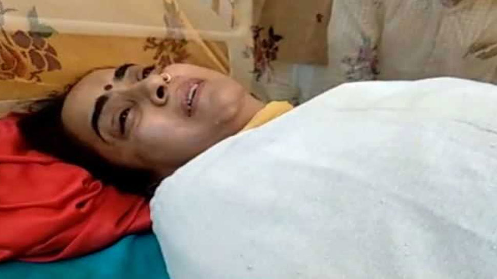 माजी महिला राज्यमंत्र्याला सासरच्यांकडून जाळून मारण्याचा प्रयत्न, आगीत 10 टक्के भाजल्या !